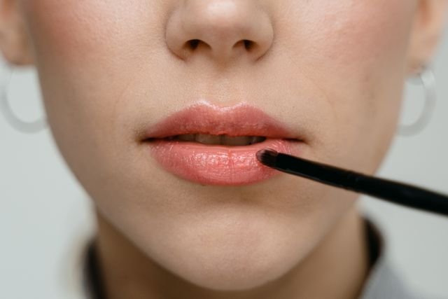 Lip Fillers
